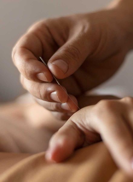 Sannsynligvis er akupunktur det eldste medisinske systemet mennesket kjenner til