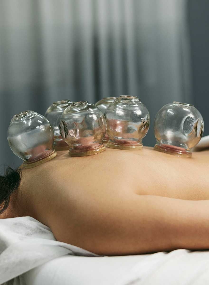 Kopping terapi er en eldgammel terapi der det brukes glasskopper på huden i noen minutter for å skape vakuum og undertrykk.